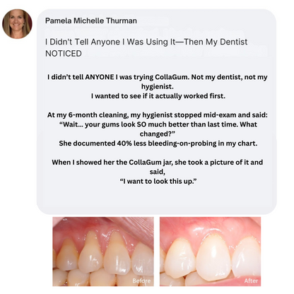 CollaGum | Eat cold food. Drink hot beverages. Smile freely. Stop gum recession—in just 14 days.