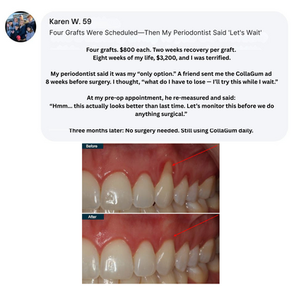 CollaGum | Eat cold food. Drink hot beverages. Smile freely. Stop gum recession—in just 14 days.