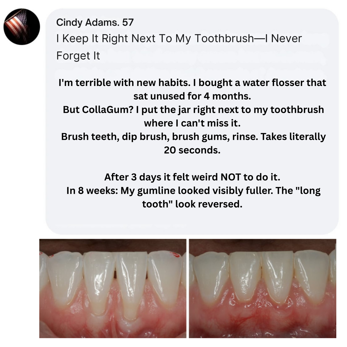 CollaGum | Eat cold food. Drink hot beverages. Smile freely. Stop gum recession—in just 14 days.